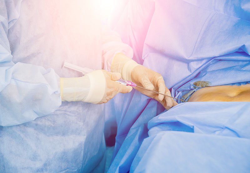 Orion Hip Arthroscopic Surgery